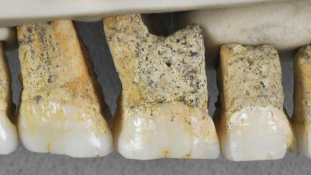 homo-luzonensis-zaehne.jpg